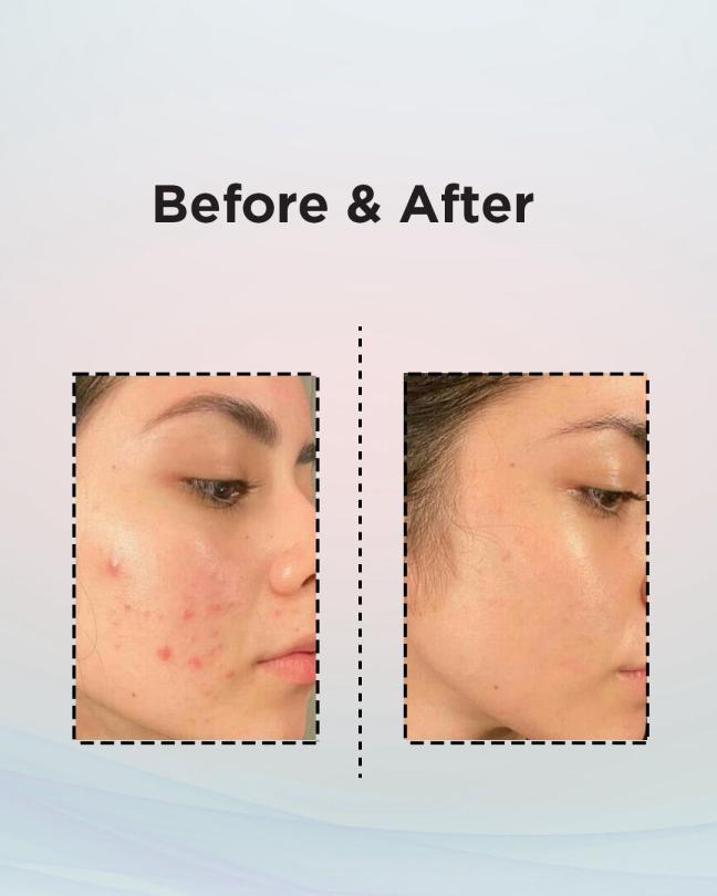Actual product image